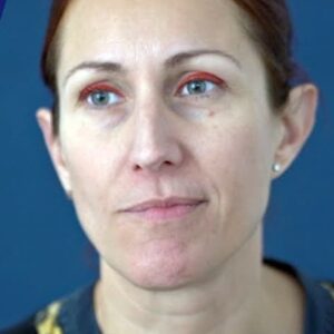 تصویر هنرمند Julie Allione