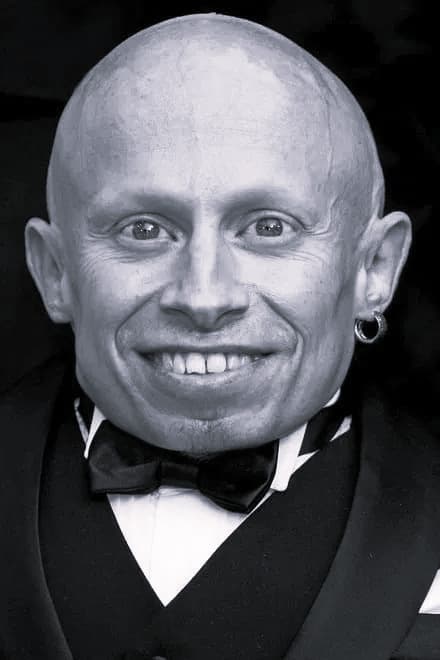 تصویر هنرمند Verne Troyer
