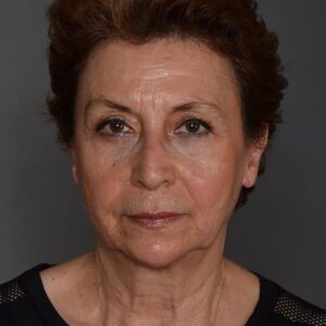 تصویر هنرمند Serra Menderes