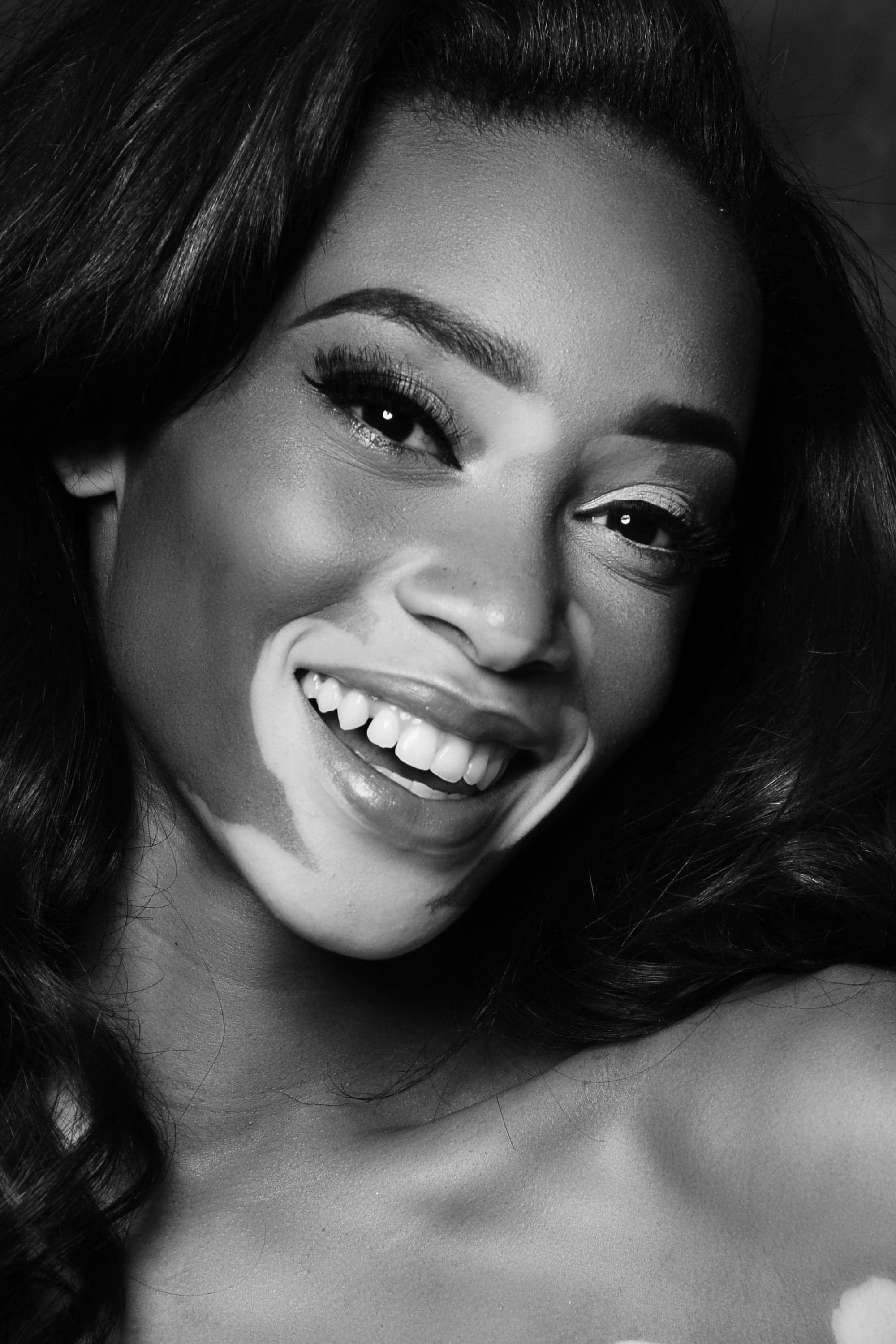 تصویر هنرمند Winnie Harlow